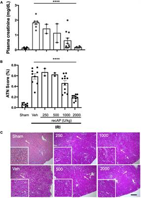 Human Recombinant Alkaline Phosphatase (Ilofotase Alfa) Protects Against Kidney Ischemia-Reperfusion Injury in Mice and Rats Through Adenosine Receptors